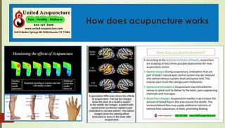 acupuncturists houston United Acupuncture