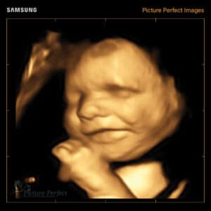 ultrasound clinics houston Picture Perfect 3D/4D Ultrasound Imaging
