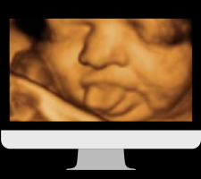ultrasound clinics houston Picture Perfect 3D/4D Ultrasound Imaging