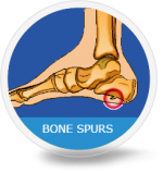 sports podiatrists houston Westside Podiatry: Sports Injuries Foot and Ankle