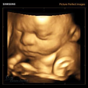 5d ultrasounds in houston Picture Perfect 3D/4D Ultrasound Imaging