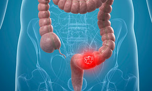 specialised doctors general surgery digestive system houston GI Specialists of Houston, LLP
